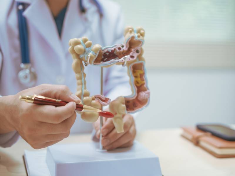 model of colon